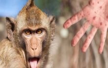 آخرین اطلاعات درباره «آبله میمون»/آیا باید از این ویروس مانند کرونا  بترسیم؟