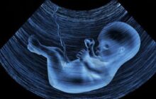 غربالگری جنین با رعایت استانداردها ممنوع نیست