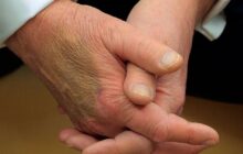 ترامپ در تلاش برای پنهان کردن کبودی مزمن دست راست