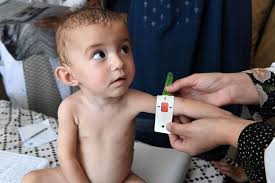 یارانه کودکان دارای سوءتغذیه واریز شد