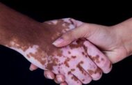 آغاز درمان یک بیماری مادرزادی با سلول‌های بنیادی در شیراز