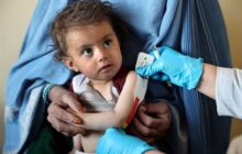سازمان ملل: 100 مرکز درمان سوءتغذیه کودکان در افغانستان تعطیل شد
