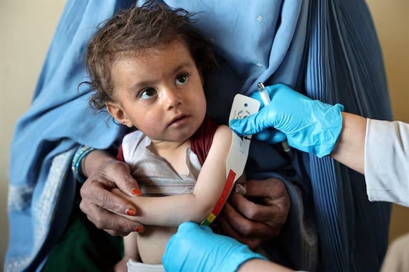 سازمان ملل: 100 مرکز درمان سوءتغذیه کودکان در افغانستان تعطیل شد